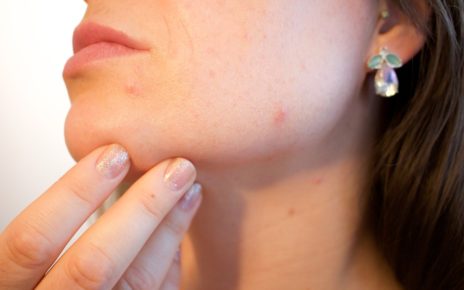 Home remedies for acne or pimple @amzwold